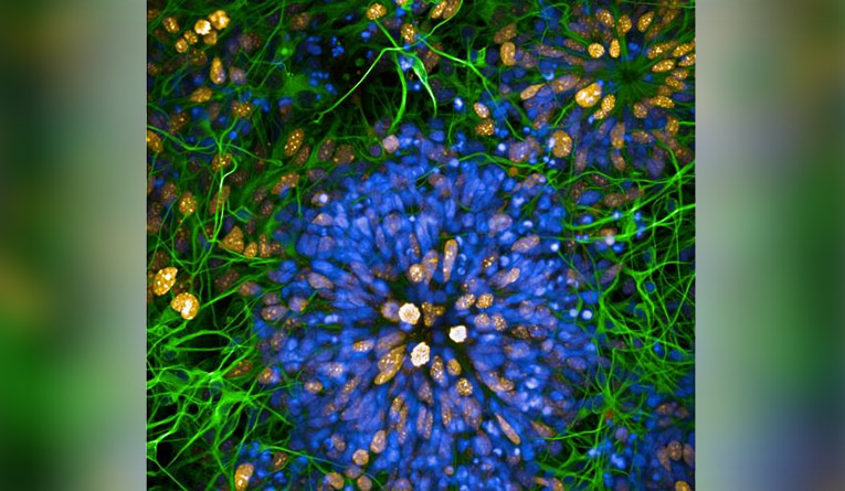 ‘Breath-taking’ Dementia Research Revealed in Alzheimer’s Society’s First Ever Research Image Competition