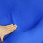 Grand(E) Way To Address Scoliosis Support